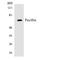 Paxillin antibody, LS-C200467, Lifespan Biosciences, Western Blot image 