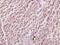 Glycerol Kinase 2 antibody, A11596Y306, Boster Biological Technology, Immunohistochemistry paraffin image 