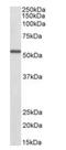 Aldehyde Dehydrogenase 6 Family Member A1 antibody, orb372998, Biorbyt, Western Blot image 
