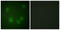 Sodium Channel Epithelial 1 Beta Subunit antibody, LS-C199337, Lifespan Biosciences, Immunofluorescence image 