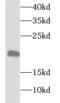 Tubulin Polymerization Promoting Protein Family Member 3 antibody, FNab08900, FineTest, Western Blot image 