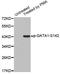 GATA Binding Protein 1 antibody, LS-C335805, Lifespan Biosciences, Western Blot image 