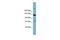 ATP Binding Cassette Subfamily B Member 4 antibody, GTX47122, GeneTex, Western Blot image 