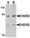 Transmembrane Channel Like 8 antibody, TA306575, Origene, Western Blot image 