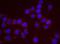 Rho Associated Coiled-Coil Containing Protein Kinase 2 antibody, NB100-593, Novus Biologicals, Proximity Ligation Assay image 