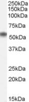 Kallikrein Related Peptidase 2 antibody, 45-808, ProSci, Western Blot image 