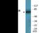 Protein Kinase C Beta antibody, EKC2578, Boster Biological Technology, Western Blot image 