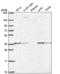 ETS Variant 1 antibody, NBP2-57731, Novus Biologicals, Western Blot image 