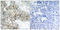 Integrin Subunit Beta 3 antibody, LS-C117385, Lifespan Biosciences, Immunohistochemistry paraffin image 