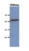 Carnosine Dipeptidase 2 antibody, AM50023PU-S, Origene, Western Blot image 