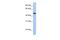 ALG2 Alpha-1,3/1,6-Mannosyltransferase antibody, PA5-43263, Invitrogen Antibodies, Western Blot image 