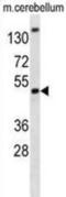 BMI1 Proto-Oncogene, Polycomb Ring Finger antibody, abx025355, Abbexa, Western Blot image 