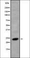 RAB8B, Member RAS Oncogene Family antibody, orb338633, Biorbyt, Western Blot image 