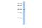 Pellino E3 Ubiquitin Protein Ligase Family Member 3 antibody, A09622, Boster Biological Technology, Western Blot image 