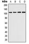 Calcium Homeostasis Endoplasmic Reticulum Protein antibody, LS-C353264, Lifespan Biosciences, Western Blot image 