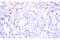 Integrin Subunit Alpha E antibody, 95835S, Cell Signaling Technology, Immunohistochemistry frozen image 