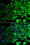 Protein Kinase AMP-Activated Catalytic Subunit Alpha 2 antibody, STJ29478, St John