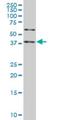 Salvador Family WW Domain Containing Protein 1 antibody, H00060485-M04, Novus Biologicals, Western Blot image 