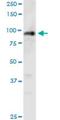 Polyhomeotic Homolog 1 antibody, H00001911-M05, Novus Biologicals, Western Blot image 