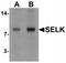 Selenoprotein K antibody, TA319992, Origene, Western Blot image 