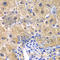 Caspase Recruitment Domain Family Member 11 antibody, A7140, ABclonal Technology, Immunohistochemistry paraffin image 