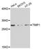 TIMP Metallopeptidase Inhibitor 1 antibody, LS-C746778, Lifespan Biosciences, Western Blot image 