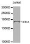 Insulin Receptor Substrate 1 antibody, abx126017, Abbexa, Western Blot image 