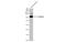 Serpin Family G Member 1 antibody, GTX636508, GeneTex, Western Blot image 