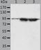 Spermatogenesis Associated 20 antibody, TA324241, Origene, Western Blot image 