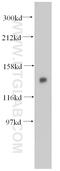 Tubulin Folding Cofactor D antibody, 14867-1-AP, Proteintech Group, Western Blot image 