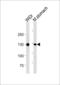 Cadherin 1 antibody, LS-B11811, Lifespan Biosciences, Western Blot image 