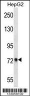 Acyl-CoA Synthetase Short Chain Family Member 2 antibody, 56-934, ProSci, Western Blot image 