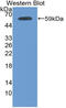 Plakophilin 1 antibody, MBS2026888, MyBioSource, Western Blot image 