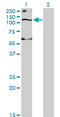 Solute Carrier Family 12 Member 4 antibody, LS-C198216, Lifespan Biosciences, Western Blot image 