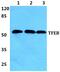 Transcription Factor EB antibody, PA5-75572, Invitrogen Antibodies, Western Blot image 