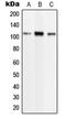 Phospholipase D2 antibody, LS-C352670, Lifespan Biosciences, Western Blot image 