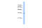 Ras Suppressor Protein 1 antibody, 30-397, ProSci, Western Blot image 