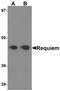 Double PHD Fingers 2 antibody, PA5-21079, Invitrogen Antibodies, Western Blot image 