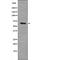 Transforming Growth Factor Beta Receptor 2 antibody, PA5-64611, Invitrogen Antibodies, Western Blot image 