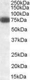 Delta Like Canonical Notch Ligand 1 antibody, GTX88445, GeneTex, Western Blot image 