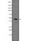 Mitochondrially Encoded Cytochrome B antibody, abx149442, Abbexa, Western Blot image 