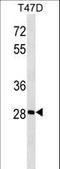 Glycerol Kinase 5 antibody, LS-C166491, Lifespan Biosciences, Western Blot image 