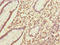 IKBKB Interacting Protein antibody, LS-C675885, Lifespan Biosciences, Immunohistochemistry paraffin image 