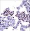 Toll Like Receptor 8 antibody, LS-C161923, Lifespan Biosciences, Immunohistochemistry frozen image 