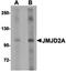 Jumonji domain-containing protein 2A antibody, orb75264, Biorbyt, Western Blot image 