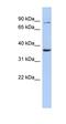 Heparan Sulfate-Glucosamine 3-Sulfotransferase 1 antibody, orb324452, Biorbyt, Western Blot image 