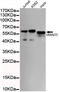 SMAD Family Member 5 antibody, STJ99081, St John