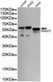 Mothers against decapentaplegic homolog 5 antibody, STJ99081, St John