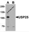 Ubiquitin Specific Peptidase 25 antibody, 7765, ProSci, Western Blot image 