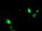 ADP Ribosylation Factor Like GTPase 11 antibody, MA5-25770, Invitrogen Antibodies, Immunocytochemistry image 